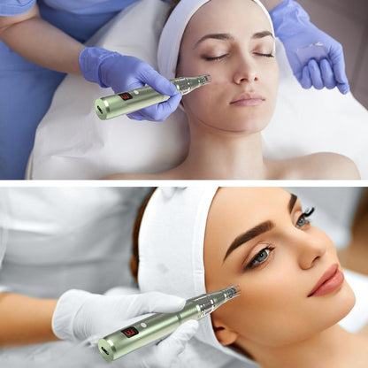 0.25mm Derma Roller Pen — Compact Grip